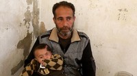  Dituturkan ayah bayi Karim, bahwa tak ada listrik dan pemanas di tempat perlindungan bawah tanah yang banyak ditinggali anak-anak tersebut. Jauh di atas tempat perlindungan tersebut, pesawat-pesawat tempur sesekali melintas. Foto: Anadolu Agency