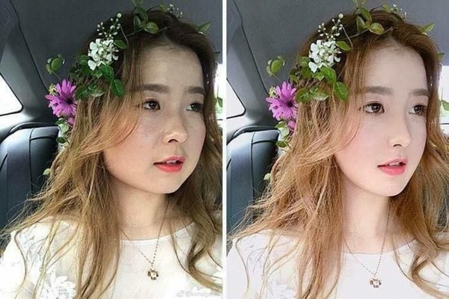 Wanita kini beralih ke operasi plastik hanya untuk menjadi apa yang mereka anggap cantik. Bahkan mereka menghabiskan banyak uang untuk membuat kulit jadi cerah, hingga tubuh lebih kurus. Foto: Dok. Kanahoooo Weibo