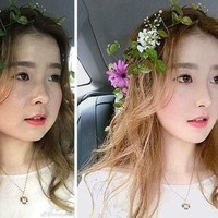 Wanita kini beralih ke operasi plastik hanya untuk menjadi apa yang mereka anggap cantik. Bahkan mereka menghabiskan banyak uang untuk membuat kulit jadi cerah, hingga tubuh lebih kurus. Foto: Dok. Kanahoooo Weibo