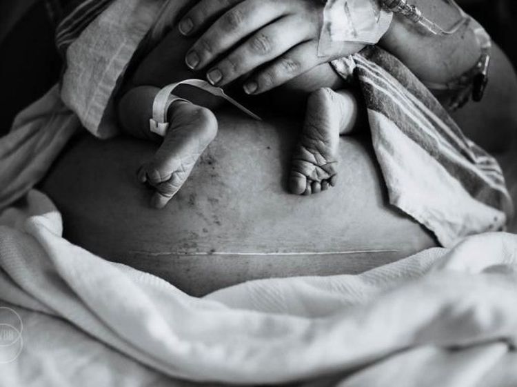 Foto-foto Menyentuh Saat Para Ibu Melahirkan