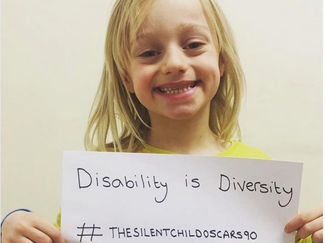 5 Nominator Oscar 2018 yang Punya Masalah Kesehatan