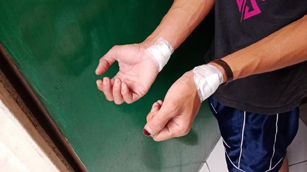 Cerita Warga yang Mendadak Dipukuli Geng Motor di Kemang