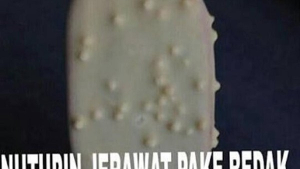 10 Meme Lucu Tentang Jerawat Membandel yang Bisa Bikin Ketawa