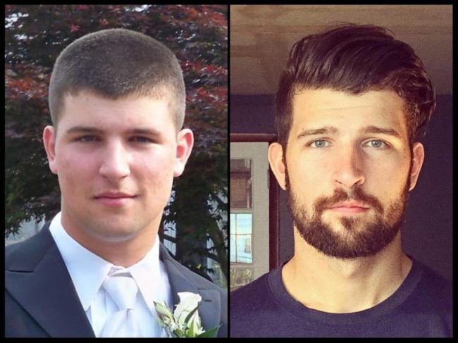 Foto kiri dan kanan merupakan orang yang sama. Tapi penampilannya kini tampak tak dikenali gara berubah jadi ganteng setelah usia 22 tahun.  Foto: dok. Reddit