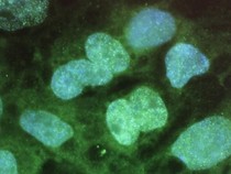 Video: Wanti-wanti Terkait Pemanfaatan Teknologi Sel Punca