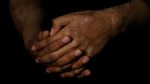Potret Korban Serangan Air Keras di Hari Perempuan Internasional
