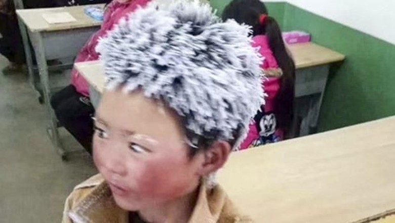 Bocah China Berambut Es Dikeluarkan dari Sekolah Barunya, Kenapa? Bocah China Berambut Es Dikeluarkan dari Sekolah Barunya, Kenapa?
