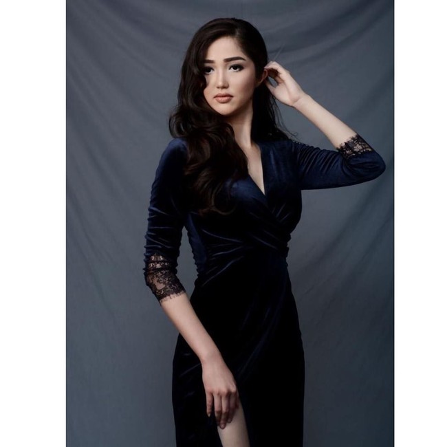 Sonia Fergina yang berusia 25 tahun merupakan sarjana Sastra Inggris dari Universitas Bina Nusantara (Binus). Seperti dikutip dari situs resmi Puteri Indonesia, Sonia dikenal sebagai orang yang aktif melakukan kegiatan sosial. Melalui organisasi “Diberi Untuk Memberi”, dia bersama dengan teman-temannya memberikan makanan secara gratis kepada petugas kebersihan dan orang-orang kurang mampu. Foto: Dok. Instagram