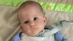 Idap Penyakit Saraf Langka, Bayi Ini Butuh Rp 1,7 M untuk Bisa Senyum