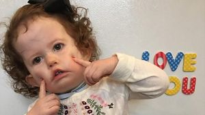 Idap Penyakit Saraf Langka, Bayi Ini Butuh Rp 1,7 M untuk Bisa Senyum