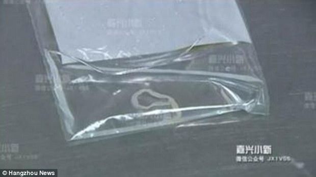 Makan Kodok untuk Obat, Payudara Malah Bengkak Terinfeksi Cacing