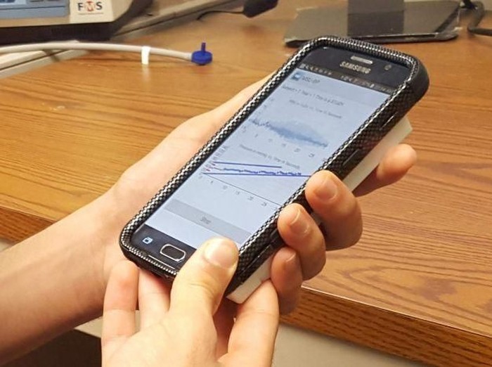 Canggih! Casing Smartphone Ini Bisa Buat Cek Tensi Darah