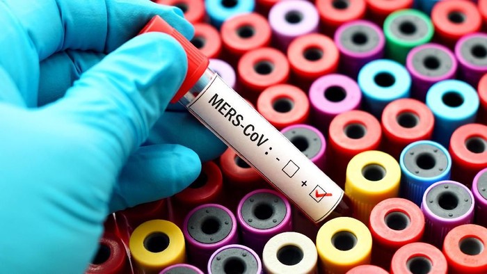 Badan Kesehatan Dunia (WHO) mengeluarkan laporan terbaru analisa virus-virus berbahaya apa saja yang perlu diwaspadai di tahun 2018 ini. Foto: ilustrasi/thinkstock Badan Kesehatan Dunia (WHO) mengeluarkan laporan terbaru analisa virus-virus berbahaya apa saja yang perlu diwaspadai di tahun 2018 ini. Foto: ilustrasi/thinkstock