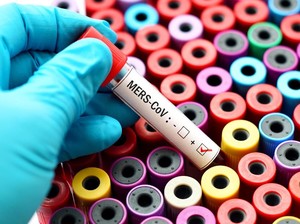 8 Virus Paling Berbahaya yang Diwaspadai WHO di 2018