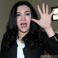 Gara-gara memiliki gigi seperti gigi kelinci, Vicky Shu sempat dituding kalau bentuk giginya yang sekarang palsu. Ia juga mengungkapkan kalau banyak yang suka mengejek bentuk tubuh dan pipinya yang chubby. Sempat sedih dengan cibiran netizen, Vicky memutuskan menghargai dirinya sendiri. Foto: Lamhot Aritonang