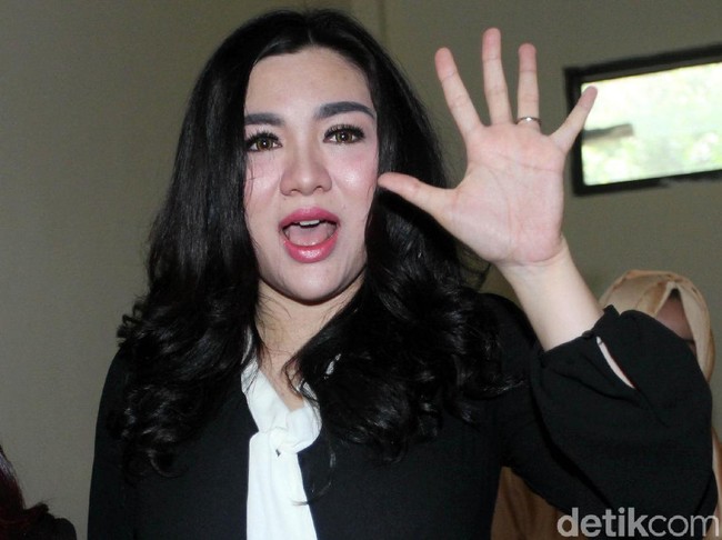 Gara-gara memiliki gigi seperti gigi kelinci, Vicky Shu sempat dituding kalau bentuk giginya yang sekarang palsu. Ia juga mengungkapkan kalau banyak yang suka mengejek bentuk tubuh dan pipinya yang chubby. Sempat sedih dengan cibiran netizen, Vicky memutuskan menghargai dirinya sendiri. Foto: Lamhot Aritonang