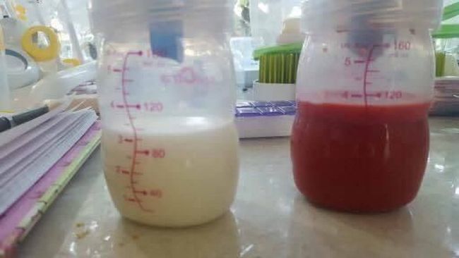Begini Kondisi ASI Saat Ibu Mengalami Masalah Menyusui