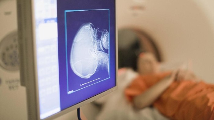 Wanita Ini Pakai Mainan Seks saat Jalani Tes MRI, Berakhir Mengenaskan