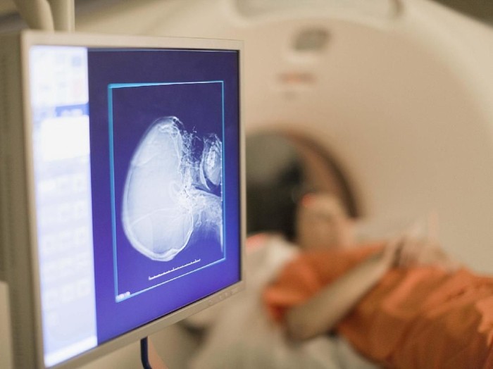 Patient in MRI machine