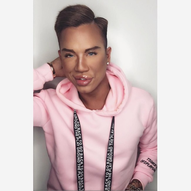 Aku mulai suntik filler sekitar dua tahun lalu dan sekarang aku dikenal karena bibirku yang besar. Tapi aku tetap tidak senang dengan ukurannya sekarang, aku mau bibirku jauh lebih besar, kata Jonny. Foto: Instagram/@jonathandylan