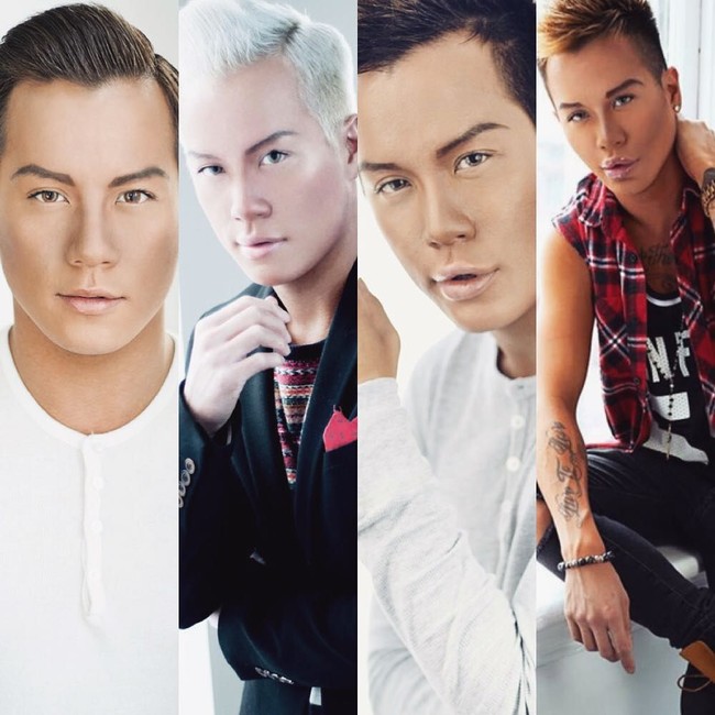 Tranformasi wajah Jonny Dylan sebelum dan setelah suntik filler dan Botox. Foto: Instagram/@jonathandylan