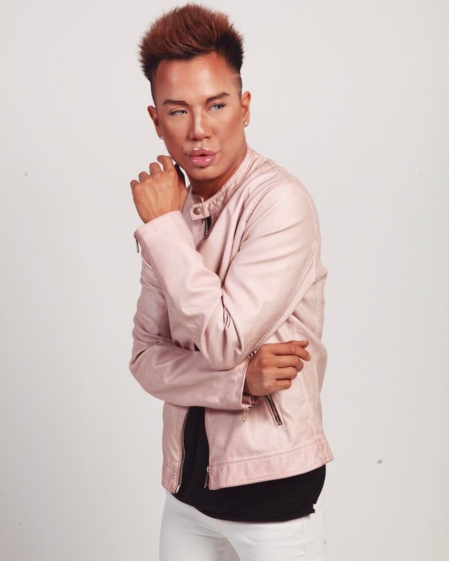 Jonny Dylan rutin suntik Botox dan filler untuk menjaga wajah palsunya. Ia mengaku menghabiskan hingga Rp 10 jutaan per bulan demi tampilan wajah mirip boneka Ken. Foto: Instagram/@jonathandylan