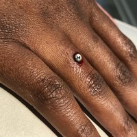 Memang butuh keberanian untuk melakukan hal seperti ini. Meski belum ada bukti efek samping, tapi terbayang nggak apa jadinya kalau cincin tersebut tersangkut sweater atau benda lainnya. Apalagi, tangan kita adalah anggota tubuh yang sangat aktif kita gunakan. (Foto: Instagram)