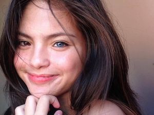 Foto: Cantiknya Julia Ostan, Remaja yang Punya 2 Warna Mata Berbeda