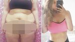 Gagal Jaga Berat Pasca Diet Keto, Si Cantik Ini Pangkas Lambungnya