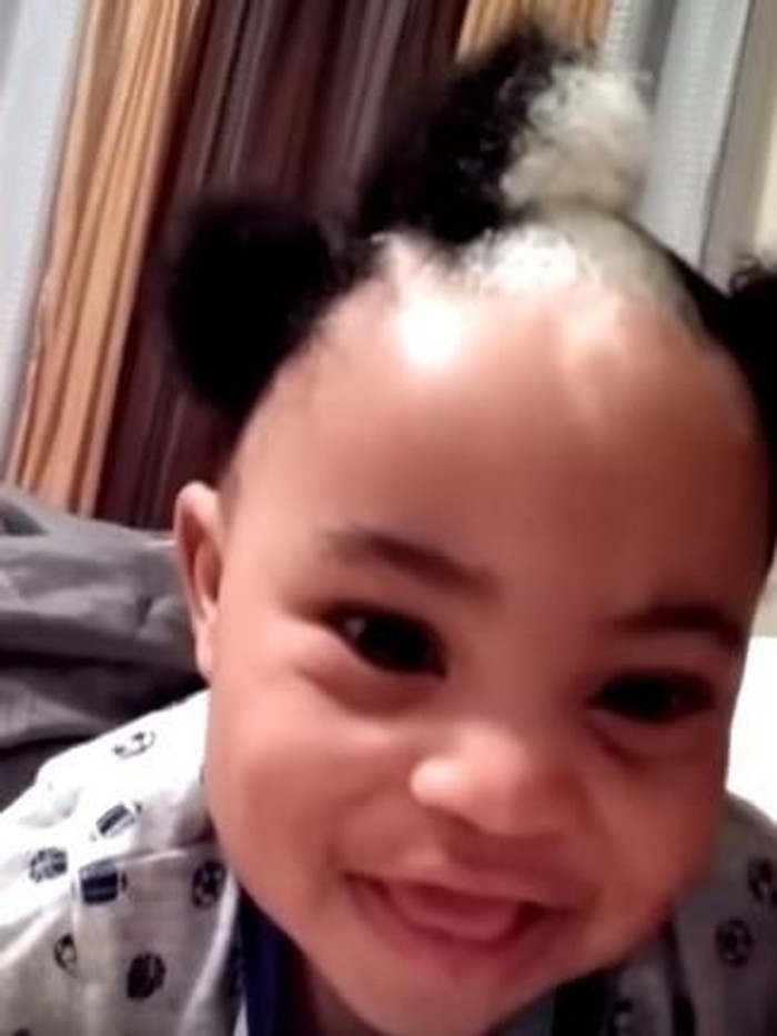 Bocah 2 Tahun Punya Tanda Lahir Lucu dan Langka di Rambutnya