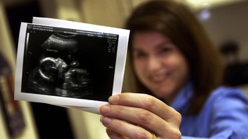 Gambar ultrasound janin. Memiliki anak adalah hal yang menggembirakan. Namun bersabarlah untuk tidak mengumbar kabar kehamilan dengan memasang foto ultrasound janin dalam kandungan. Foto: Stephen Morton/Getty Images