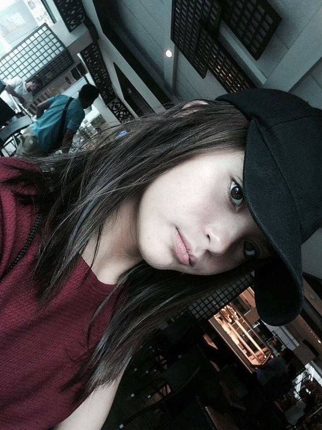 Menurut Kickerdaily, meski memiliki kelainan pada bola matanya, Julia mengaku tak merasa sakit atau penglihatannya kabur. Foto: Facebook