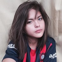 Pada dunia medis, kasus yang dialami oleh remaja asal Bacolod, Filipina ini disebut sebagai kelainan pada mata yang sering dianggap heterochromia, yakni memiliki warna mata yang berbeda antara satu dengan yang lainnya. Foto: Facebook