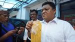 Foto: Jari Manis Mahasiswi Bandung yang Dipaksa Pakai Cincin