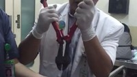 Shelma pun lantas mendatangi RSHS. Dokter di rumah sakit ini pun membuka cincin yang melekat di jari manis Shelma dengan alat yang mirip tang berukuran besar. Sang dokter sampai harus menggunakan dua tangannya/ Foto: Istimewa