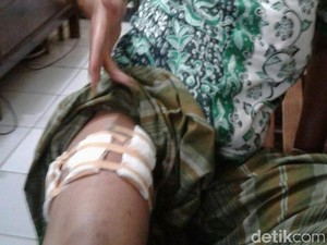 Anggota Satpol PP Rembang Tertembak Saat Berkelahi dengan Tetangga