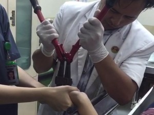Cerita Dokter RSHS Lepas Cincin Horor David di Jari Shelma