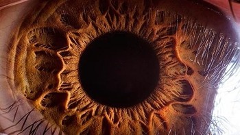 Dia adalah Suren Manvelyan seorang fotografer profesional sejak tahun 2006 yang tinggal di Yerevan, Armenia. (Foto: Suren Manvelyan)