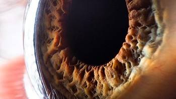 Dia bisa buka tutup dan wide angle. Tapi kalau dilihat sedetail ini, menurut kamu bagaimana, keren atau malah seram? (Foto: Suren Manvelyan)