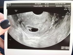Mulanya Dinyatakan Infertil, Tapi Akhirnya Perempuan Ini Hamil
