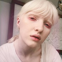 Seluruh tubuh Nastya berwarna putih, bahkan rambutnya pun demikian. Foto: Instagram