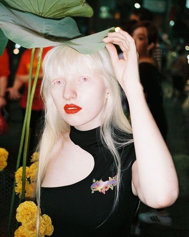 Warna bola mata Nastya yang terlihat merah muda ini pun disebut indah. Foto: Instagram