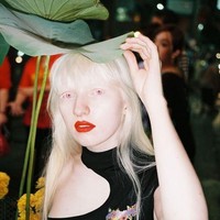 Warna bola mata Nastya yang terlihat merah muda ini pun disebut indah. Foto: Instagram