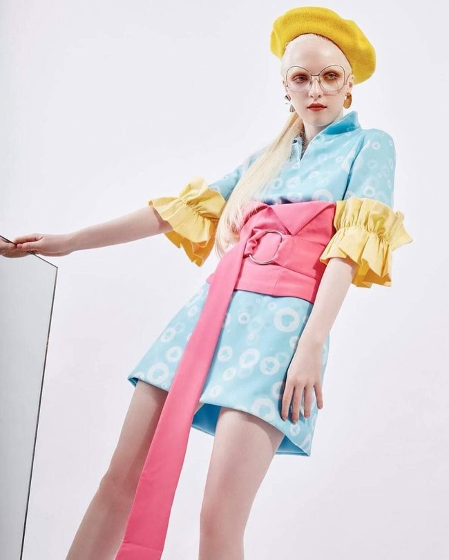 Nastya membuktikan pada dunia bahwa siapa saja bisa terlihat cantik dengan keunikan yang dimilikinya. Foto: Instagram