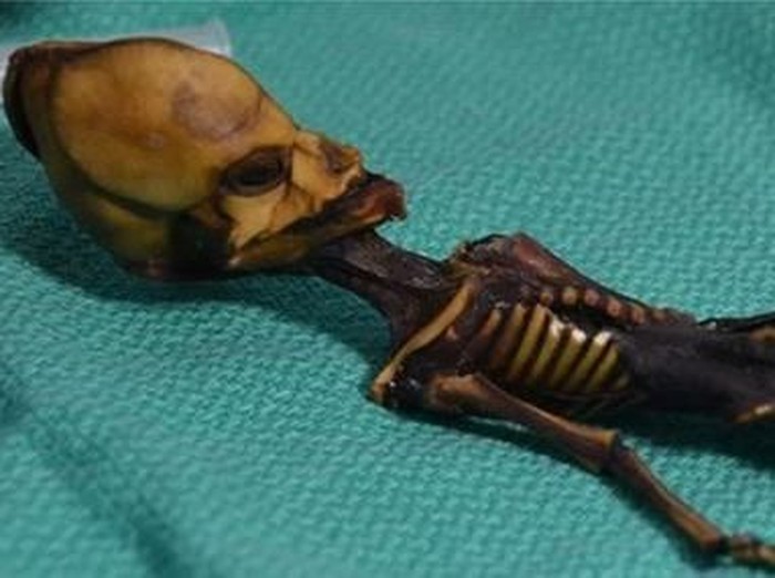 Mumi Ata sebelumnya diduga jenazah alien. (Foto: BBC) Mumi Ata sebelumnya diduga jenazah alien. (Foto: BBC)