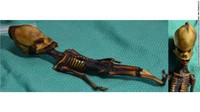 Temuan mumi ini memicu misteri. Mulai dari panjangnya hanya 15 cm. Kemudian bentuk tengkorak yang lonjong dan lancip di atas. Rongga mata yang memanjang. Hingga jumlah tulang rusuk yang hanya 10 pasang, tidak 12 pasang seperti manusia normal. Foto: Sanchita Bhattacharya/University of California San Francisco