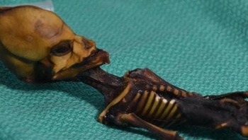 Mumi aneh di Atacama: Tahun 2003, kerangka setinggi 15 cm dengan kepala runcing ditemukan menjadi mumi secara alami di Gurun Atacama, Chili. Meski banyak orang mengklaim bahwa kerangka tersebut adalah alien, para ilmuwan telah mampu mengurutkan dan mempelajari DNA-nya. Ata, sebutan untuk mumi perempuan tersebut, ternyata adalah seorang manusia. Dia memiliki hubungan paling dekat dengan penduduk asli Chili tapi juga punya keturunan Eropa. Para peneliti menemukan tujuh mutasi berbeda pada gennya yang terkait dengan pertumbuhan, namun mereka tidak yakin apa yang menyebabkan malformasi tulangnya. Foto: Dr. Emery Smith/AFP