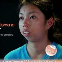 Pertumbuhan gigi gadis 20 tahun itu jadi tak rata. Karena dagunya yang masuk ke dalam, gigi fon menjadi lebih maju. Tak jarang orang mengolok penampilan fisiknya. Fon kerap diejek bergigi tonggos. Foto: Dok. Instagram, Istimewa