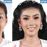 Wanita asal Thailand ini bertransformasi jadi gadis cantik jelita. Dulunya, teman-temannya kerap mengolok fisiknya karena bagian wajahnya yang tidak simetris.  Foto: Dok. Instagram, Istimewa