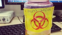 Lelah minuman selalu diminta orang lain di rumah sakit? Bikin aja botol minum seperti sampel urine. (Foto: Instagram)